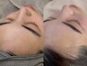 毛穴洗浄＋フルフェイスWAX＋エレクトロポレーション導入15,000円
