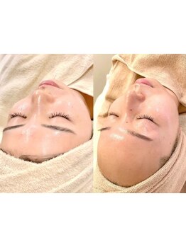 お肌をきれいにしたい