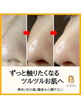 ブプラ 光の森店(BUPURA)/ビフォーアフター