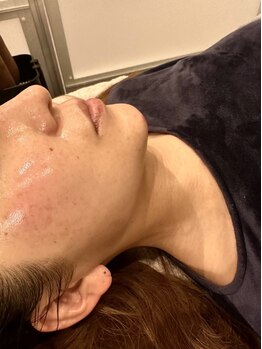 ホウレイ線・たるみ改善！予防ケア