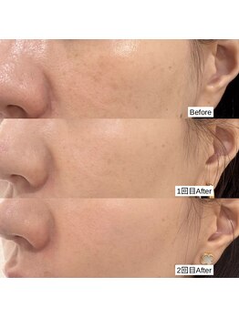 ラ クレール ビューティーサロン(LA CLAIR)/ホワイトラボ