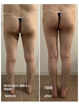 エムプラス(Mplus.)/話題のビジリス♪