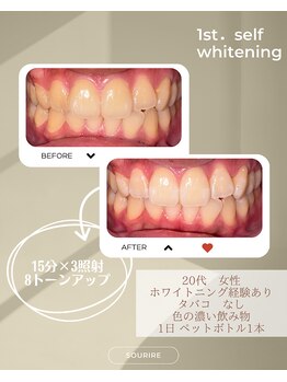 スリール(sourire)/