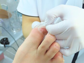 巻き爪補正店 秋葉原店の写真/《特許取得の切らない巻き爪ケア》痛み/歪み/変形等長年のお悩みを解決。日常生活が楽になる喜びを[秋葉原]
