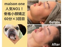 メゾンワン(maison one)/1番人気！骨格小顔矯正3回目