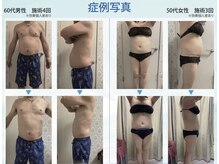 シュシュ(CHUCHU)の雰囲気（最新脂肪冷却マシン/5面アルミ冷却カップ+EMS機能搭載）