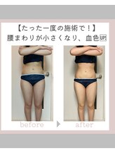  ジュエル(JEWEL)/腰周りがサイズダウン！