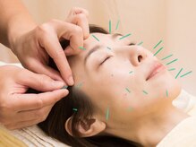 三越前はり灸整骨院/美容鍼でターンオーバー