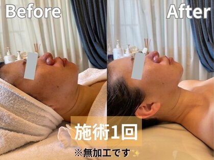 ルアナアイナ 久屋大通の写真