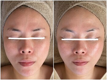 メイン(main)/★before after★