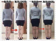 あかり整体の雰囲気（猫背骨盤矯正：3～4回目のビフォーアフター。頭から足先まで施術）