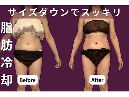 パラアモール(Paraamor)の写真