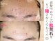 ソワンドビジュー(soin de bijew)の写真