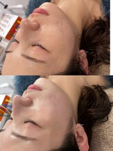 マホロバ セカンド(mahoroba 2nd)/ララピール／よもぎ蒸し