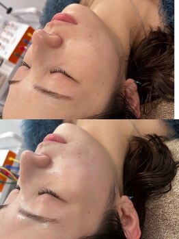 マホロバ セカンド(mahoroba 2nd)/ララピール／よもぎ蒸し