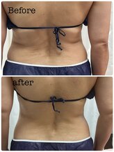 アスピリア(aspirer a')/痩せ体質に変わる！全身痩身◎