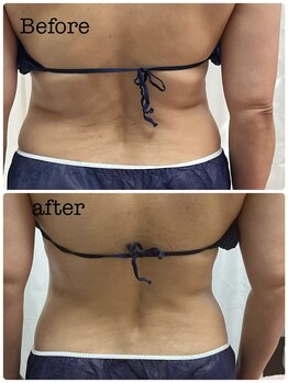 アスピリア(aspirer a')/痩せ体質に変わる！全身痩身◎