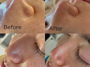 キララフェイシャル(kirara facial)/メンズ大歓迎