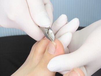 メディカルケア 朝霞台鍼灸整骨院/爪切り