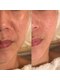 レオティアラ(REOTIARA)の写真/40代50代たるみ改善が得意！ほうれい線改善で美肌を目指し、シワ改善ケアを丁寧に行う至福の時間へ♪