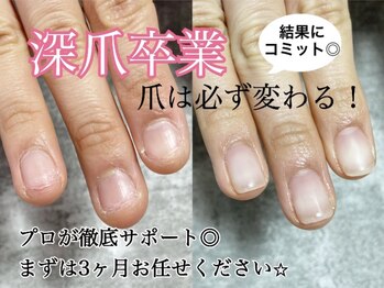 ケーネイル(K.nail)