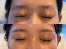 エーワキシング(A.Waxing)/