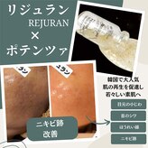 キレナル(KIRENAL)