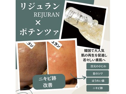 キレナル(KIRENAL)の写真