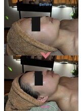 プーモア(Puu Moa)/デコルテ・首オイルマッサージ