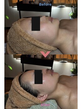 プーモア(Puu Moa)/デコルテ・首オイルマッサージ