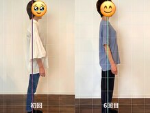 合の手の雰囲気（骨盤を突き出したポッコリお腹やストレートネックもお任せを！）