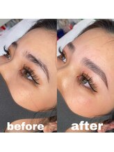 ロアリィ(LOARY)/