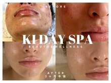 キーデイスパ(KI Day Spa)