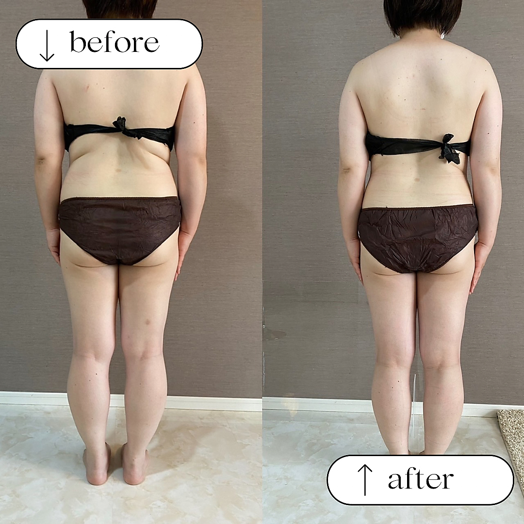 トータルビューティーサロンリア(Li'a)/ビフォー＆アフター