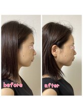 小顔整体 優/アゴもとがります♪