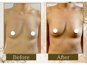 マリン(MARINE)/Before→After