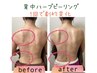 【背中激変】　REVIハーブピーリング(背中)　22,000円→15,000円