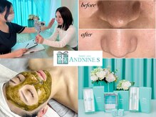 アンドナイン エス店(ANDNINE.)の雰囲気（長年の肌悩み…本気の肌質改善を求める方へ最適の施術をご提案！）