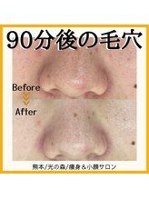 ブプラ 光の森店(BUPURA)/ビフォーアフター