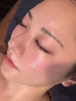 サロンドゥードゥー(SALON DOUDOU)の写真/≪憧れの韓国肌へ≫アナタの肌悩みに最適な施術を◎肌質改善ピーリング＋肌トラブルケア！ウルツヤ素肌へ