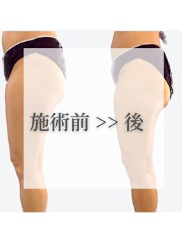 リム ビューティー(RYM BEAUTY)/施術前後RymBeauty