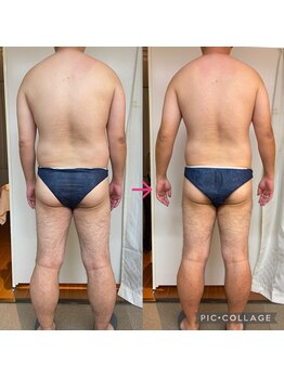 リリーローズ(LilyRose)/おなか背中おしりやせ