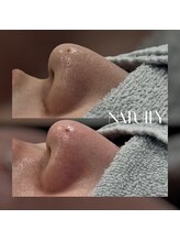 ナチュリー(Natully)/お客様ビフォーアフター