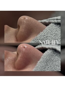ナチュリー(Natully)/お客様ビフォーアフター