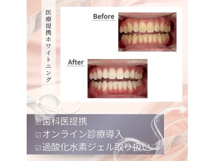 プティー(putih)の写真