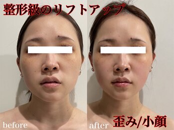 クリア(CLEAR)の写真/口腔矯正×美整顔でメス要らずの小顔、リフトアップ、歪み改善