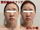 クリア(CLEAR)の写真/口腔矯正×美整顔でメス要らずの小顔、リフトアップ、歪み改善