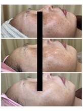 エヴェリーナ(Eveliiina)/50代女性