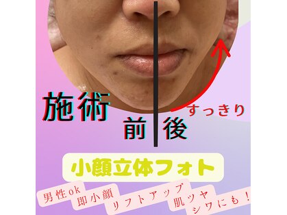 アクア(akua....)の写真