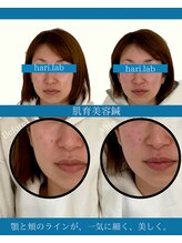 ハリラボ(hari Lab.)/【お客様の声】